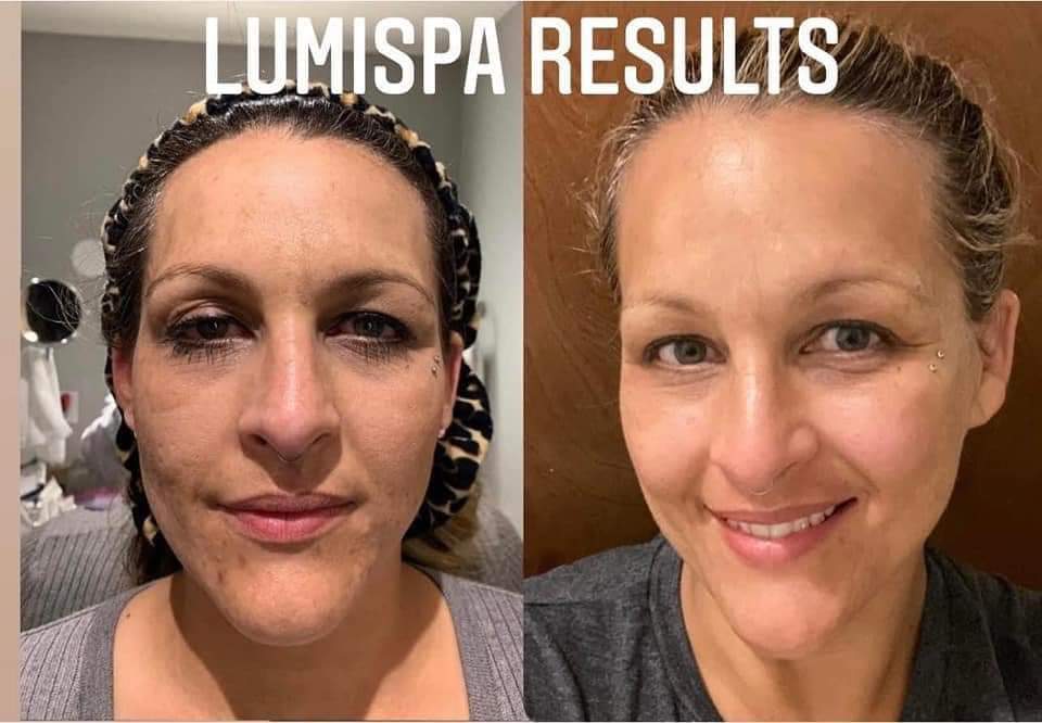 LumiSpa Blue + Cleanser