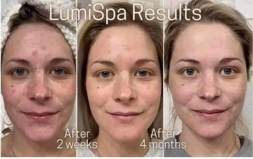 LumiSpa Blue + Cleanser