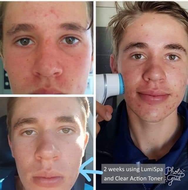 LumiSpa Rose Gold + Cleanser