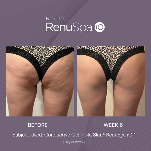 ReNu Spa iO